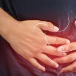 Cara Mengatasi Maag dengan Tepat dan Aman